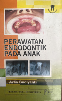 Image of Perawatan Endodontik Pada Anak